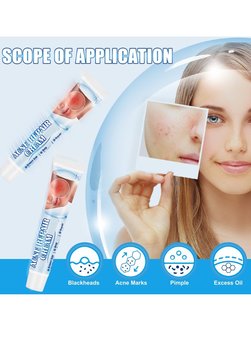 سوميفون علاج حب الشباب، كريم إزالة حب الشباب، يعمل على إصلاح حفر حب الشباب، تفتيح علامات حب الشباب وكريم إزالة البقع، يرطب ويقلص المسام، للاستخدام ليلاً ونهارًا، 20 جم - Image 3