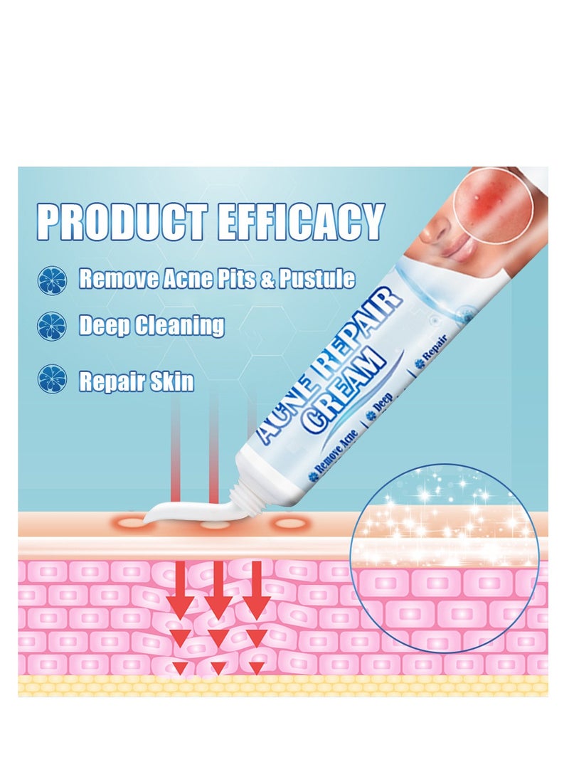 سوميفون علاج حب الشباب، كريم إزالة حب الشباب، يعمل على إصلاح حفر حب الشباب، تفتيح علامات حب الشباب وكريم إزالة البقع، يرطب ويقلص المسام، للاستخدام ليلاً ونهارًا، 20 جم - Image 4
