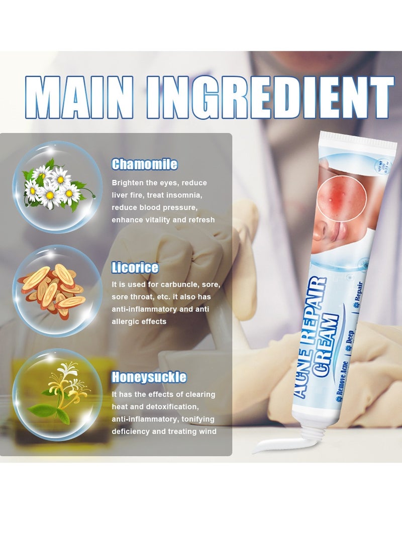 سوميفون علاج حب الشباب، كريم إزالة حب الشباب، يعمل على إصلاح حفر حب الشباب، تفتيح علامات حب الشباب وكريم إزالة البقع، يرطب ويقلص المسام، للاستخدام ليلاً ونهارًا، 20 جم - Image 5