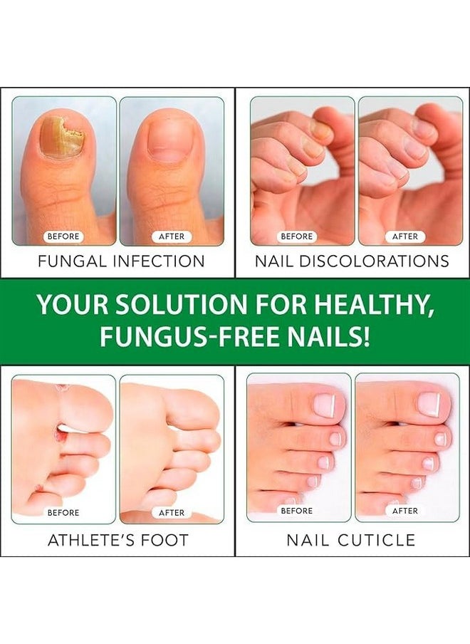 Viking Revolution Toenail Fungus Treatment Extra Strength With 1% Tolnaftate Otc Nail Fungus Treatment For Toenail Tea Tree Oil Fungus Nail Treatment Athletes Foot Toe Fungus Treatment Oregano Oil  - Image 2