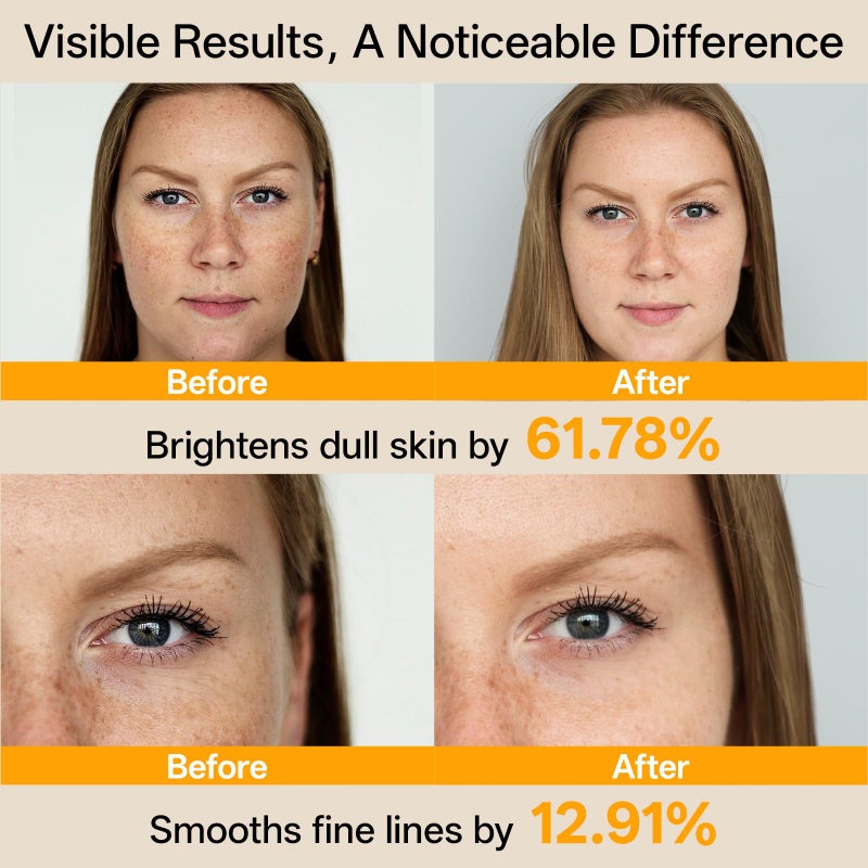 WNP Vitamin C Serum for Face - Dermatologist Tested Anti-Aging & Brightening with Hyaluronic Acid & Vitamin E, Treatment for Dark, Age, Sun Spot, Melasma, Hyperpigmentation, Fine Lines & Wrinkles - Image 3