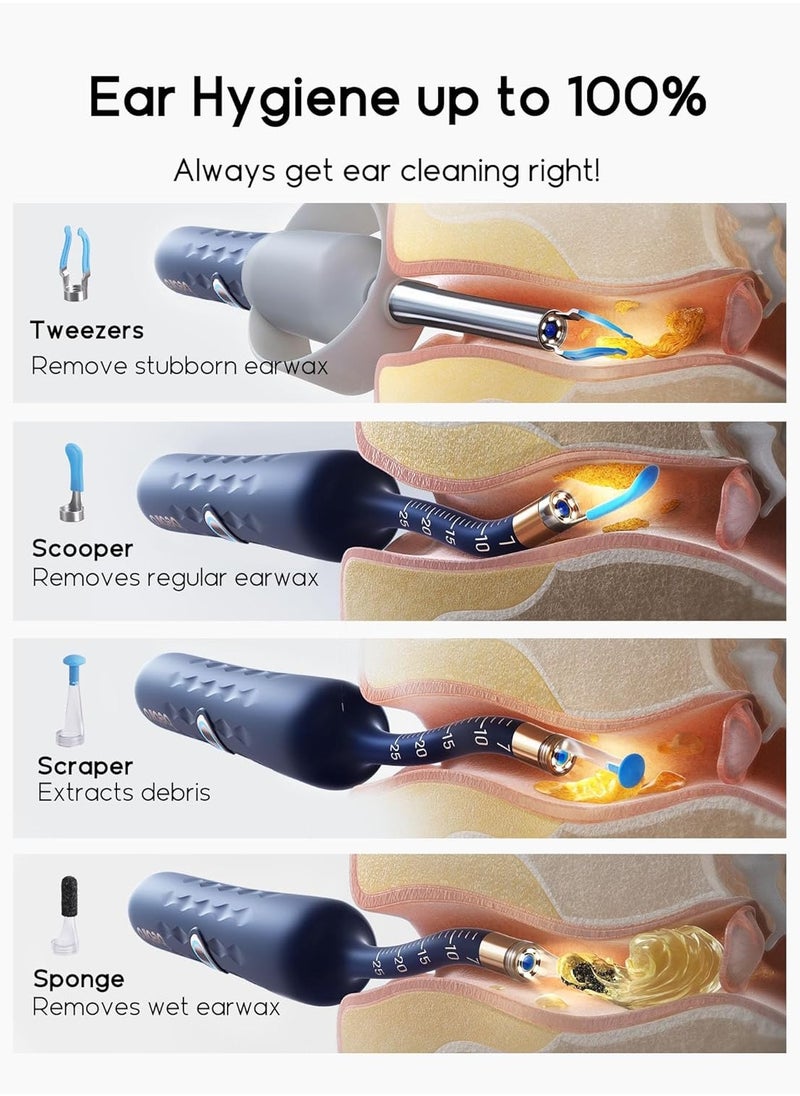 Bebird - Ear Wax Removal Tool Ear Cleaner with Flexible Wireless Ear Camera Otoscope Painless Visual Ear Pick Tweezers Wax Remover Portable Ear Cleaning Kit for Adults/Kids - Image 1