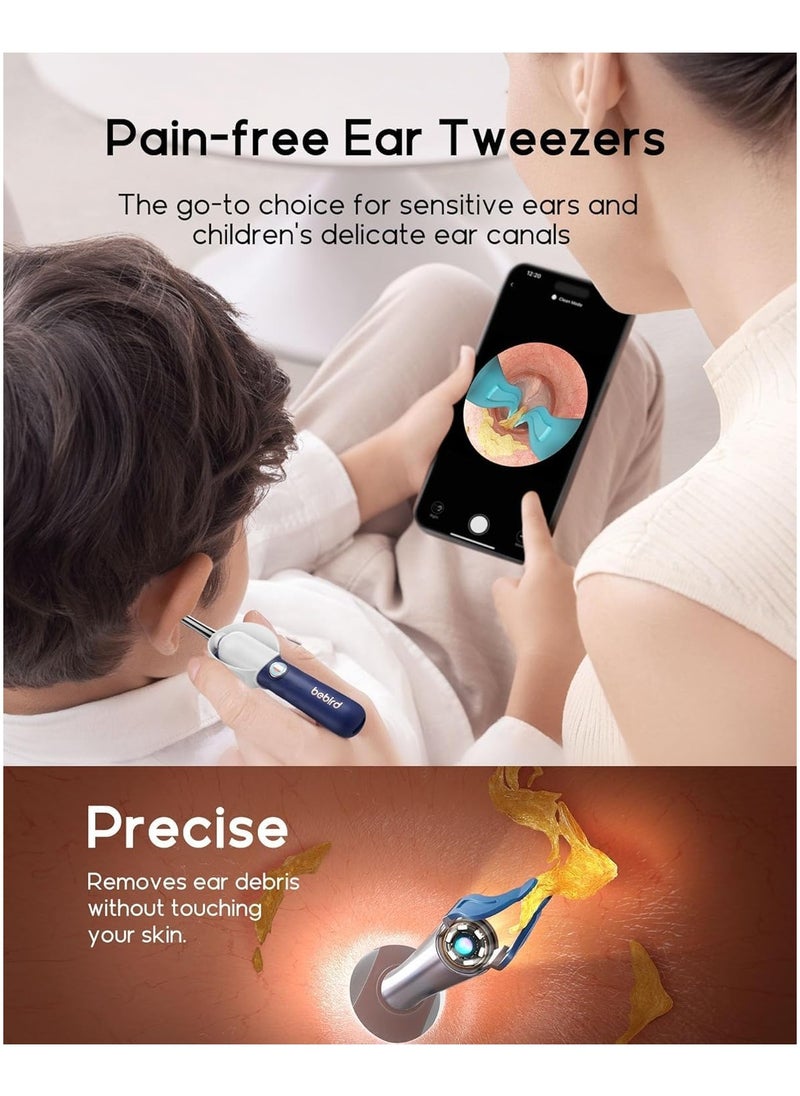 Bebird - Ear Wax Removal Tool Ear Cleaner with Flexible Wireless Ear Camera Otoscope Painless Visual Ear Pick Tweezers Wax Remover Portable Ear Cleaning Kit for Adults/Kids - Image 1