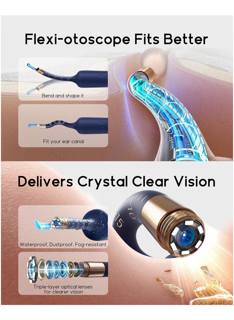 Bebird - Ear Wax Removal Tool Ear Cleaner with Flexible Wireless Ear Camera Otoscope Painless Visual Ear Pick Tweezers Wax Remover Portable Ear Cleaning Kit for Adults/Kids - Image 1