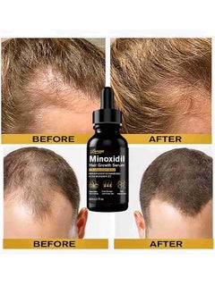 LUNOON Minoxidil Hair Growth Serum, 5% Minoxidil Hair Regrowth and Beard Growth 60ml, For Hair Loss Control & Hair Growth In Men & Women, Dermatologist Recommended  - Image 3