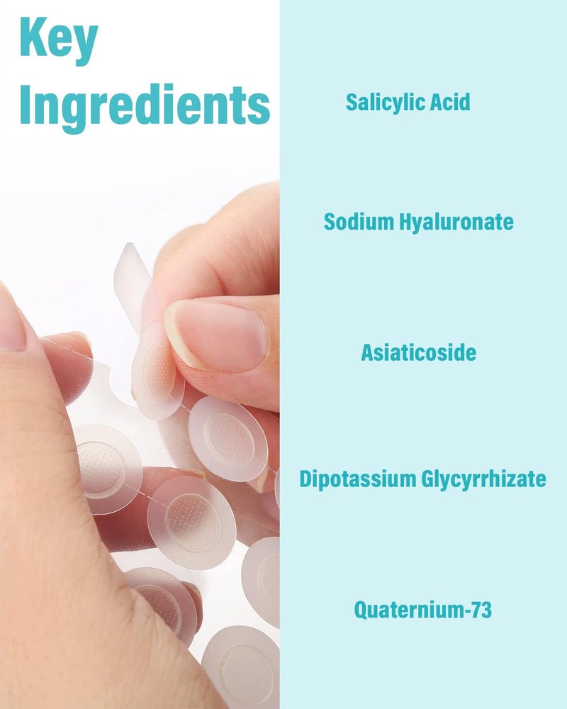 +1HEROLABS Microdart Acne Patch (36 Patches) - Hyaluronate Acid & Salicylic Acid Hydrocolloid Pimple Patch for Deep, Early and Hidden Blemishes (36 Count (Pack of 1)) - Image 3