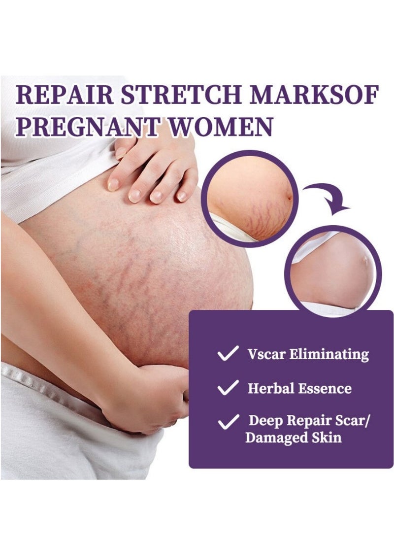 HBESTY Skin Scar Cream，Body Scar Removal，Silicone Scar Gel, Scar Cream，Scar Gel，Acne Scar Treatment，Deep Acne Scar Removal， Burns Keloids Hypertrophic， Scar Removal Cream， Repair Damaged Skin，Removing Acne Marks, Scar Repair Cream ﻿  - Image 2
