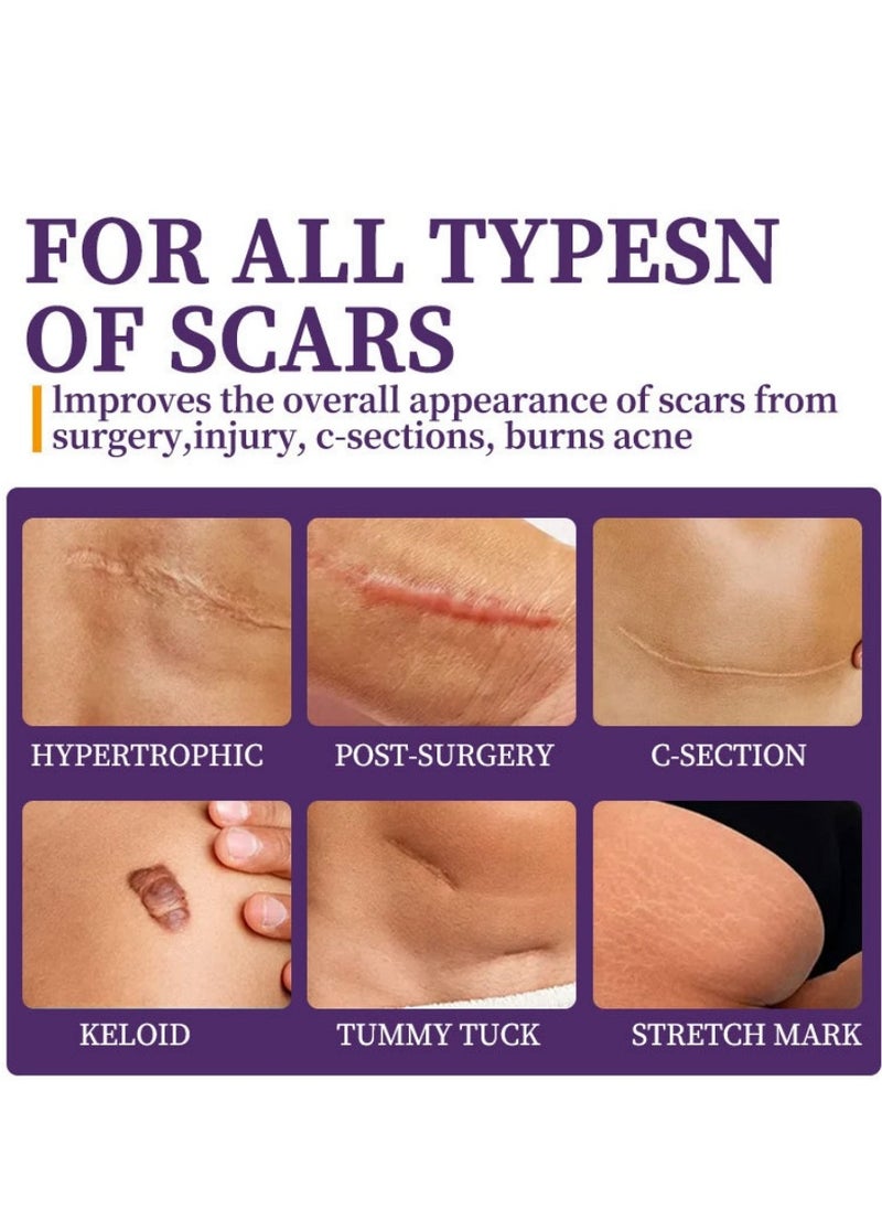 HBESTY Skin Scar Cream，Body Scar Removal，Silicone Scar Gel, Scar Cream，Scar Gel，Acne Scar Treatment，Deep Acne Scar Removal， Burns Keloids Hypertrophic， Scar Removal Cream， Repair Damaged Skin，Removing Acne Marks, Scar Repair Cream ﻿  - Image 4