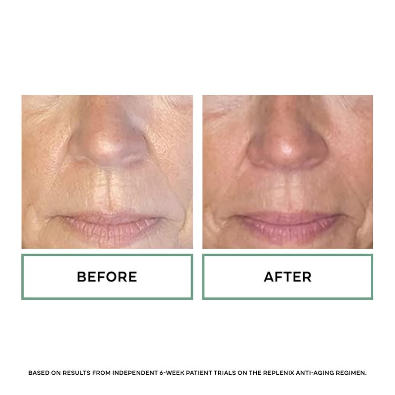 Replenix Age Restore Nighttime Therapy Face Cream, Anti-Aging Medical-Grade Facial Moisturizer for Mature & Dry Skin (0.5 fl oz) - Image 5