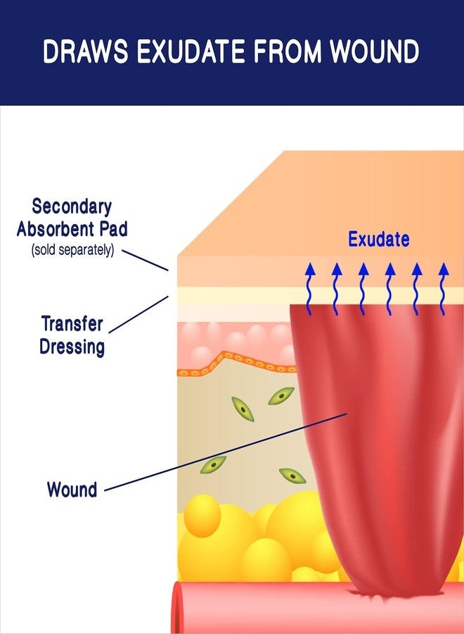 Medvance Absorbent Transfer Silicone Adhesive Wound Dressing - Waterproof, Sterile Wound Dressing - Easy-Apply & Breathable Bandages for Hard-to-Dress Wounds, 6 ''x8 '' (Box of 5) - Image 5