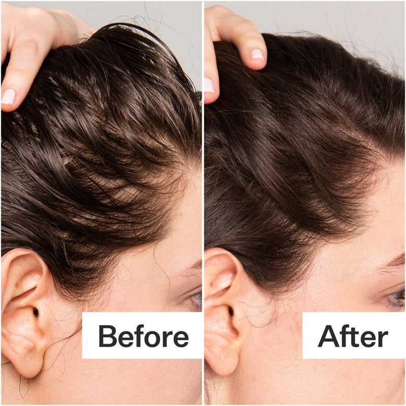Act+Acre ACT+ ACRE Scalp Exfoliator, Cold Processed BHA Salicylic Acid, Plant Based, Relief for Dry Itchy Scalp, Exfoliating Mask for Oily Hair, 2 Fluid Ounces - Image 5