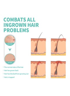 EELHOE Razor Bump Solution，Prevents Ingrown Hair  Reduce Dark Spot Reduce Redhess And Bumps，Hair Growth Inhibitor Safe and Gentle, Delay Hair Growth, No Black Spots，Roll-on 100ml  - Image 4