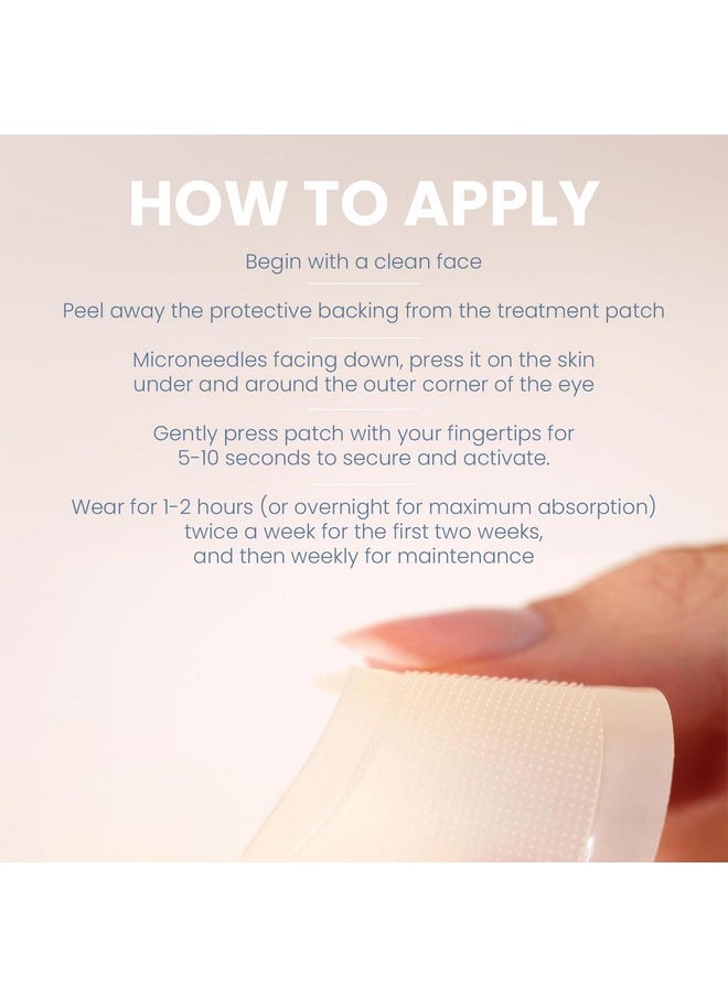 skyn ICELAND - Skyn ICELAND Dissolving Microneedle Under Eye Patches With 39% Hyaluronic Acid & Peptides. No-Slip Eye Mask to Firm And Reduce Wrinkles & Fine Lines, 1 Pair - Image 1