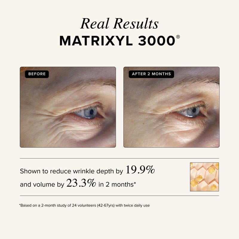 Asterwood Matrixyl 3000, Argireline Peptide, Vitamin C Cream - Triple Repair - with Hyaluronic Acid - Anti-Aging, Wrinkle Reducing, Hydrating - Fragrance-Free - 1.7 Fl Oz - Image 4