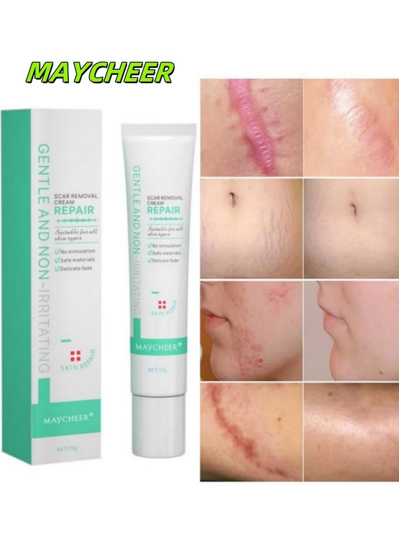 MAYCHEER Professional Scar Treatment - Reduces Appearance of Scars, Stretch Marks & Discoloration - Image 1