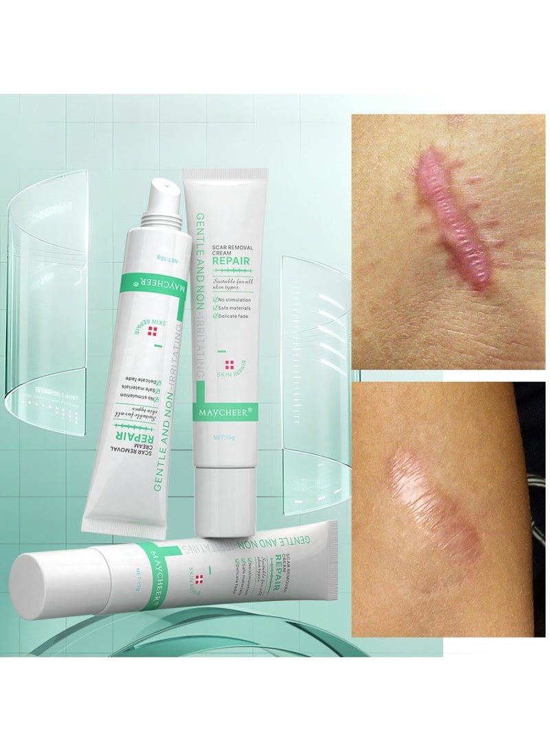 MAYCHEER Professional Scar Treatment - Reduces Appearance of Scars, Stretch Marks & Discoloration - Image 5