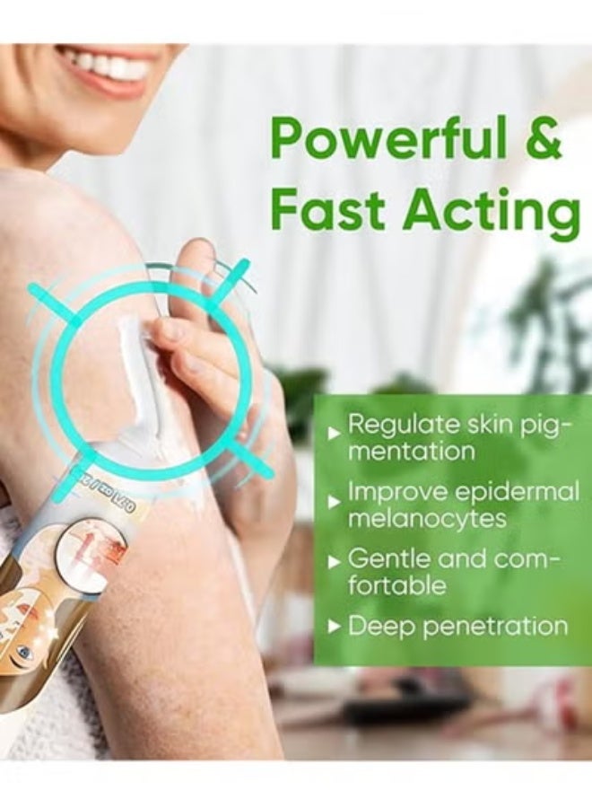 سوميفون جروفورج كريم العناية بالبهاق للبشرة البهاق (قطعتان) تقليل البقع البيضاء كريم البهاق الصدفية البقع البيضاء علاج البهاق تحسين تصبغ الجلد - Image 4