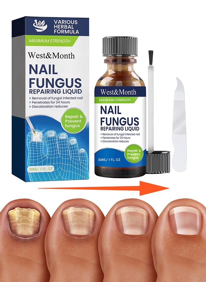 West&Month Nail Repairing Liquid - Speedy and Effective Approach to Toenail Issues - Combating Thick, Discolored Nails - Powerful Solution for Addressing Yellow and Brown Nails - for Thick, Broken, Discolored & Damaged Nail - 30ML - Image 1