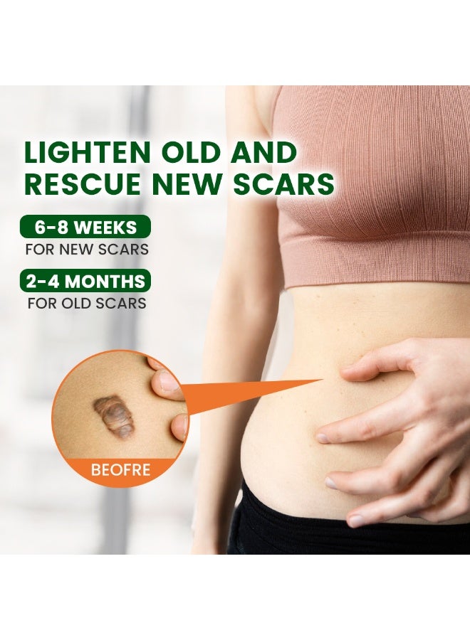 Sumifun Scar Repair Gel Medical-Grade Silicone Improves Texture & Color New & Old Scars For Face & Body 30G - Image 5