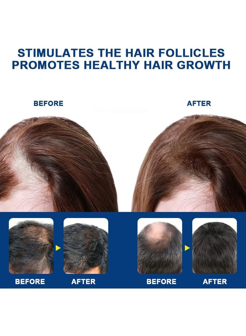 Sumifun Hair Growth Cream, Dense Prevent Alopecia, Baldness, Hair Roots, Nourishing, Scalp Treatment, Hair Straighten, Shiny Conditioner - Image 4