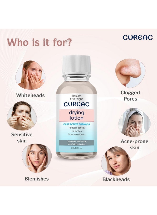 Salve Soothing and Cooling Acne Drying Lotion with Calamine - 30 ml - Image 4