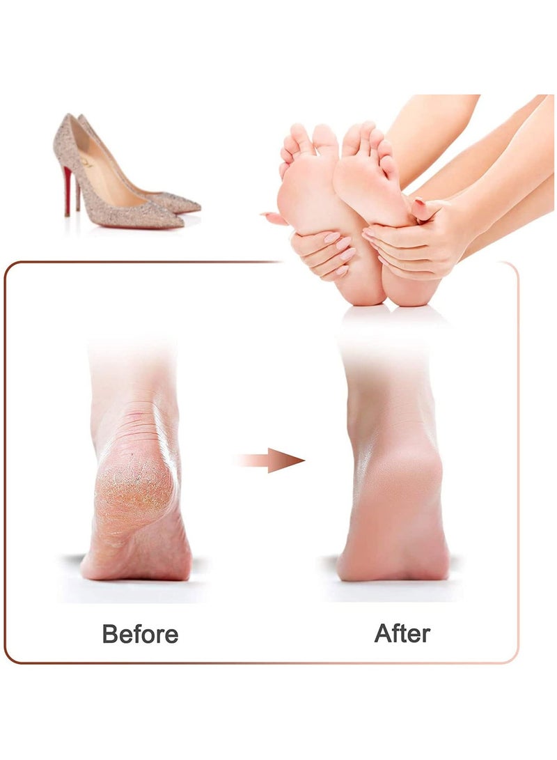 Electric Callus Remover,Foot Hard Skin Remover, Rechargeable Electronic Feet File Pedicure Foot with IPX7 Waterproof Design Proffessinal Feet Care with 2 Speed for Cracked Heels and Dead Skin - Image 2