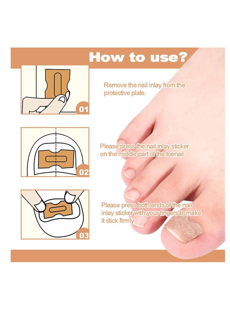 ECVV لصقات إصلاح الأظافر متعددة الاستخدامات 50 قطعة، علاج إصلاح أظافر القدم لفطر الأظافر، علاج لمدة 8 ساعات لاستعادة المظهر الصحي - Image 2