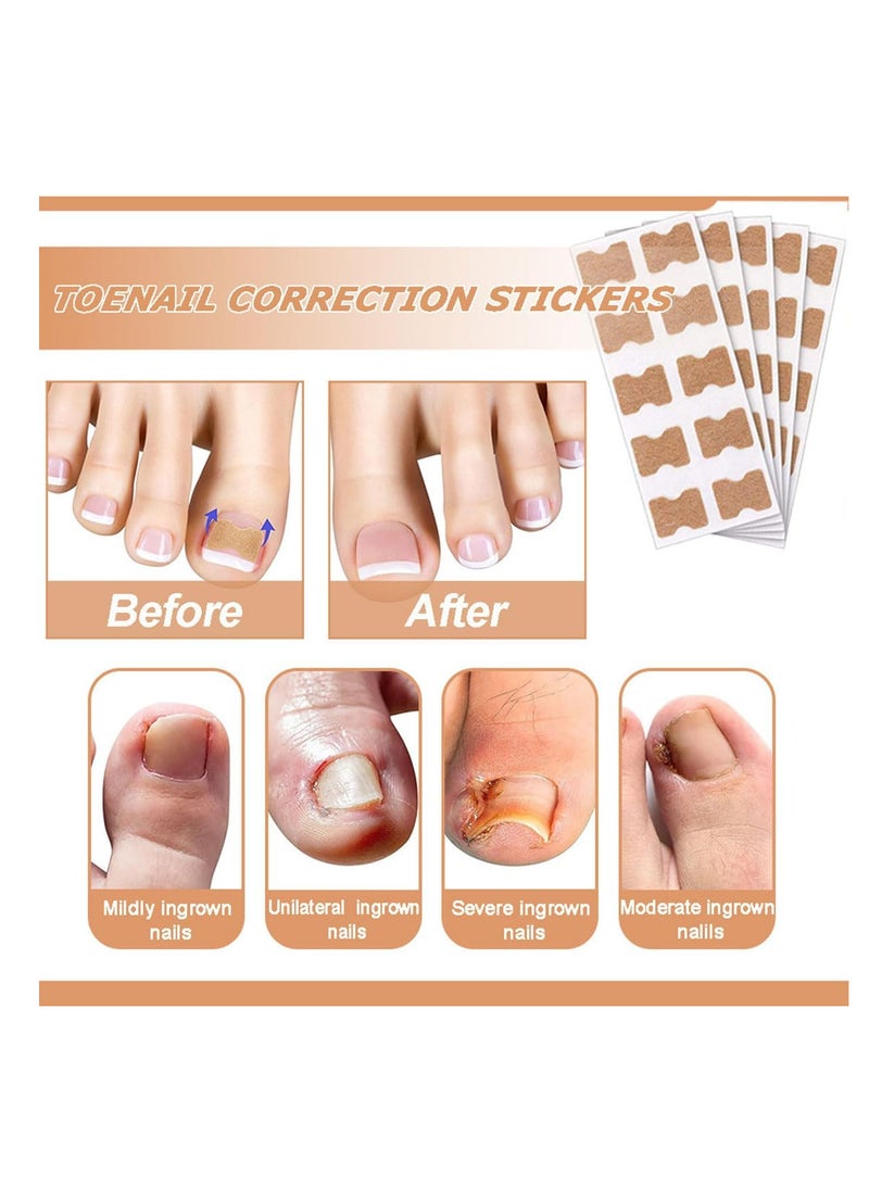 ECVV لصقات إصلاح الأظافر متعددة الاستخدامات 50 قطعة، علاج إصلاح أظافر القدم لفطر الأظافر، علاج لمدة 8 ساعات لاستعادة المظهر الصحي - Image 3