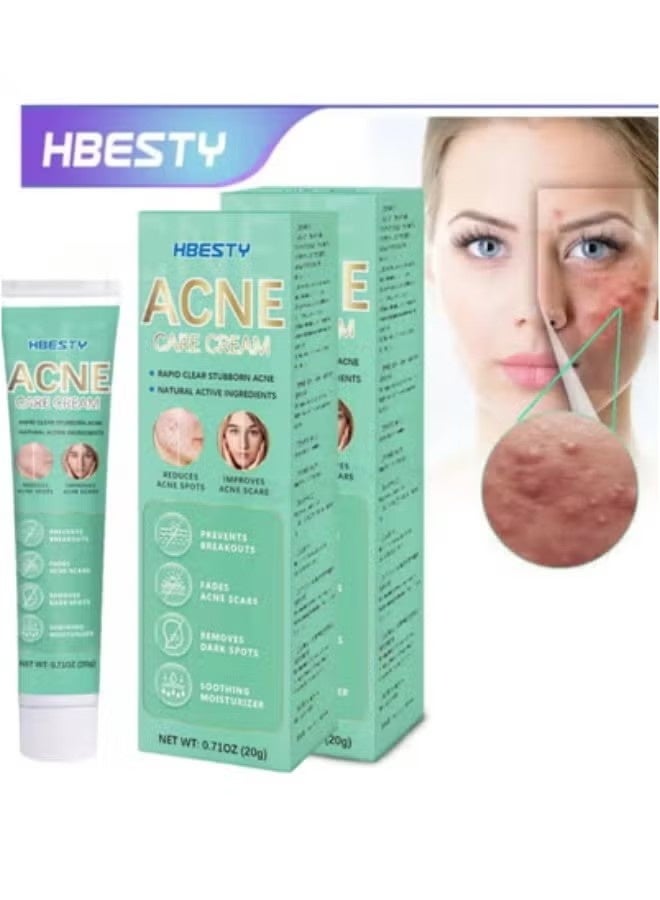 هيبستي كريم علاج حب الشباب بحمض الساليسيليك من HBESTY 20 جرام × 2 | تحكم الزيوت، يعالج حب الشباب الكيسي والفطري، يزيل البثور، يزيل ندبات حب الشباب وآثارها، إصلاح بقع حب الشباب للوجه والظهر والفخذين - Image 1