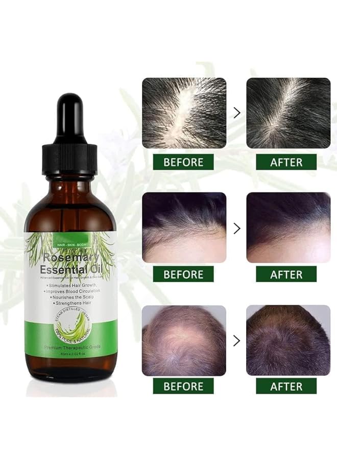 Zaboon Essential Oil, Rosemary Hair Growth Oil, Oil for Hair Growth & Skin Care, Stimulates Hair Growth, Strengthens Hair, Nourishes Scalp, Rid of Itchy and Dry Scalp, for Men Women, 60 mL（3PCS - Image 3