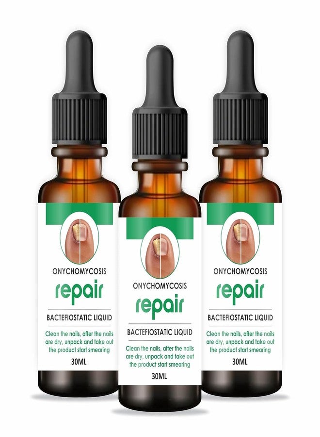 HER HEAL زيت إصلاح فطريات الأظافر - سيروم مزيل للفطريات والعدوى، قطرات سائلة للأظافر التالفة (عبوة من 3 قطع سعة 30 مل) - Image 1