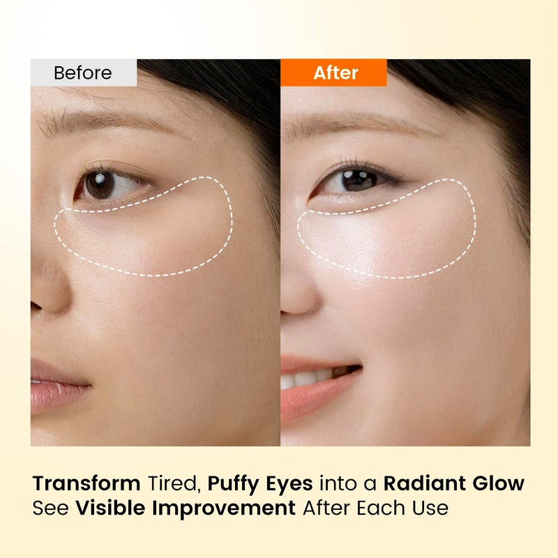 SEONGLOW Caffeine Under Eye Patches: 30 Pairs Korean Hydrogel Eye Masks for Dark Circles Puffiness Relief with Niacinamide Hyaluronic Acid - Undereye Brightening Hydrating Anti-Wrinkle Treatment - Image 5