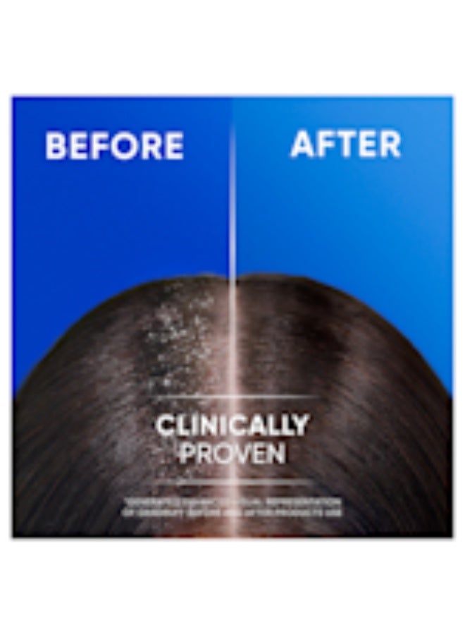 إتش آند إس شامبو إتش آند إس برائحة التفاح المنعشة 600 مل - Image 3