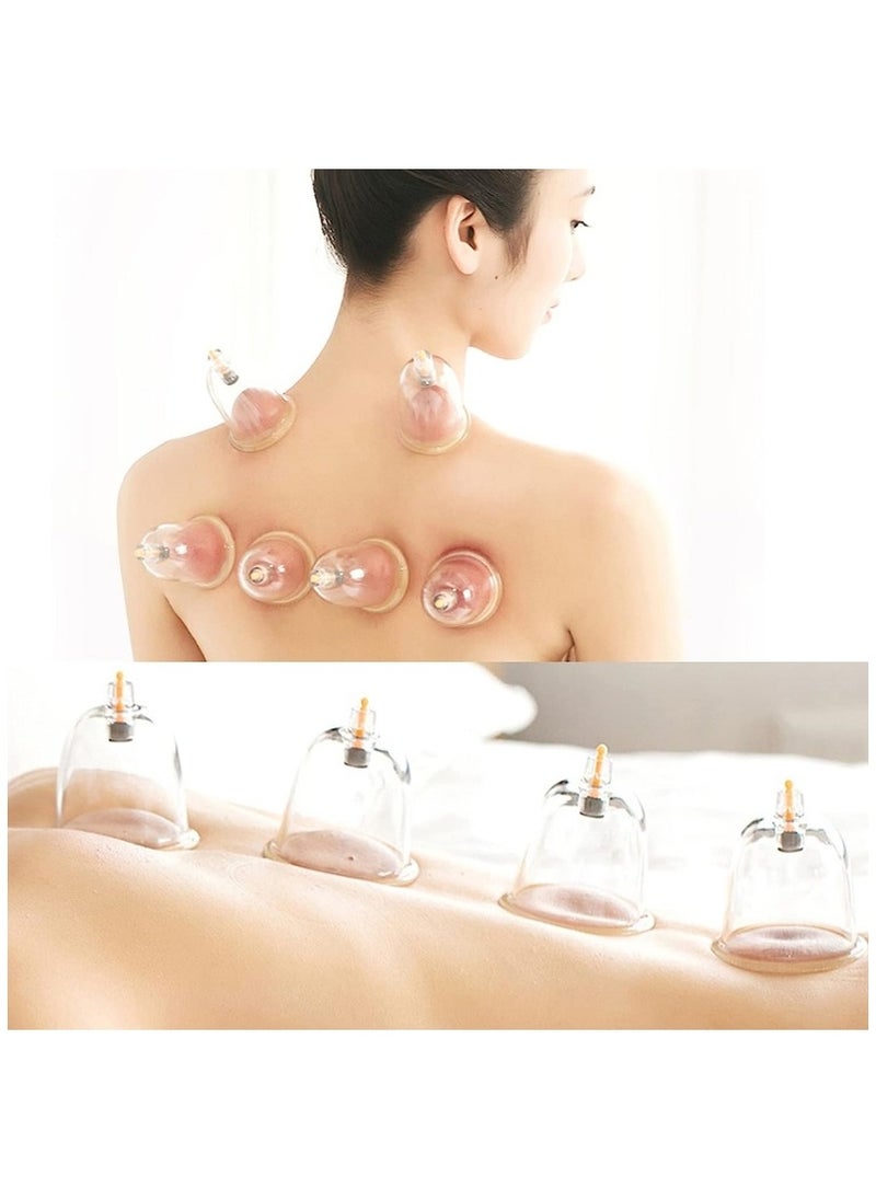 Ru syanl 22-Cup Professional Chinese Acupuncture Points Cupping Hijama Therapy Set with Vacuum Magnetic Pump  - Image 4