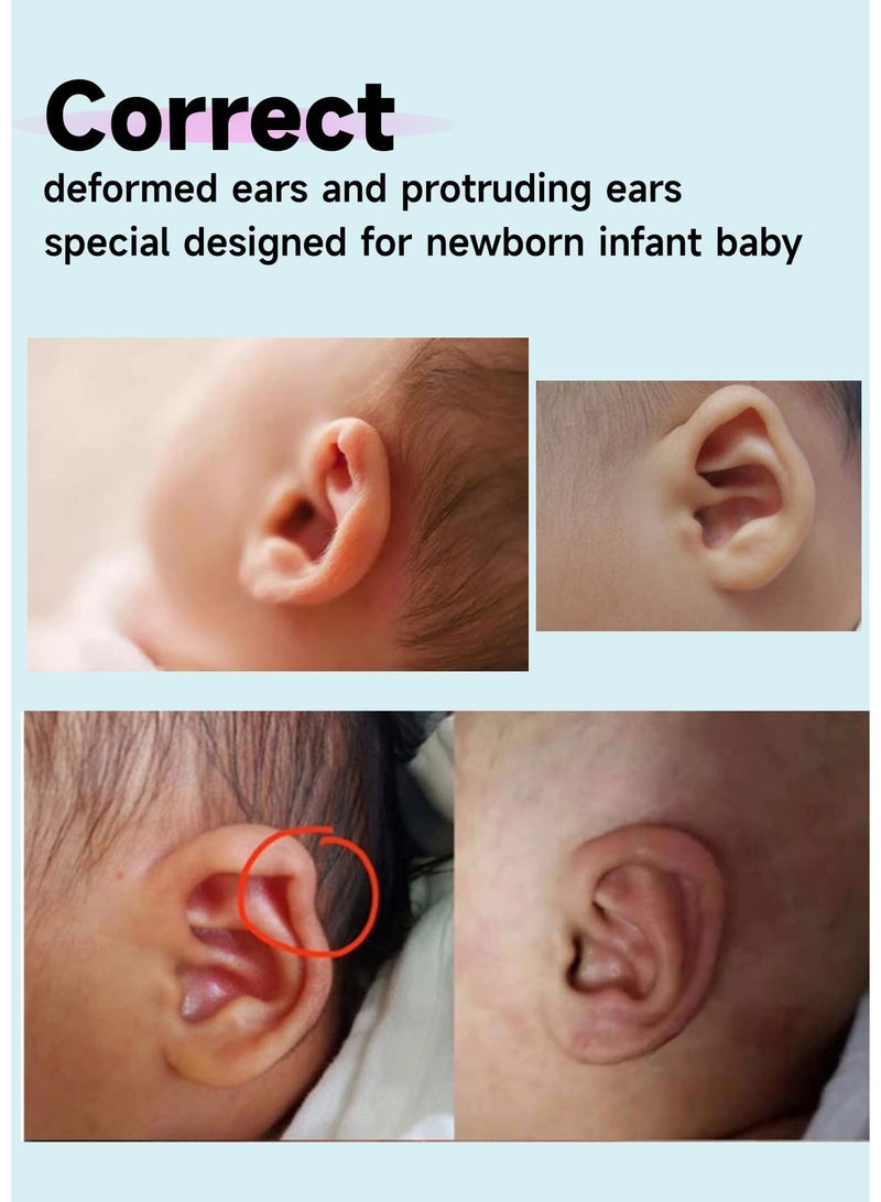 KHAJUL Auricle Valgus Correction Patch for Baby, Children Ear Correction, Newborn Baby Ear Aesthetic Correctors, Infant Protruding Ear Stickers (4cm*100cm) - Image 4