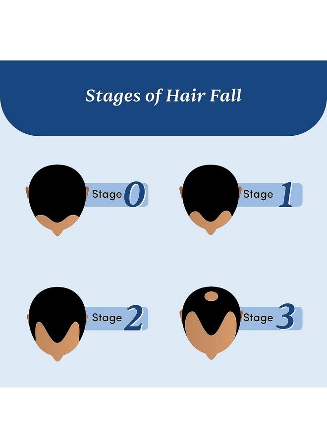 Man Matters - Biotin Hair Gummies [30N] & Anti Hair Fall Shampoo [200Ml] ; With Dht Blocker Biotin Caffeine ; Stage 1 Hair Loss Kit ; Improves Scalp Health Strengthens Hair Reduces Hair Fall - Image 1