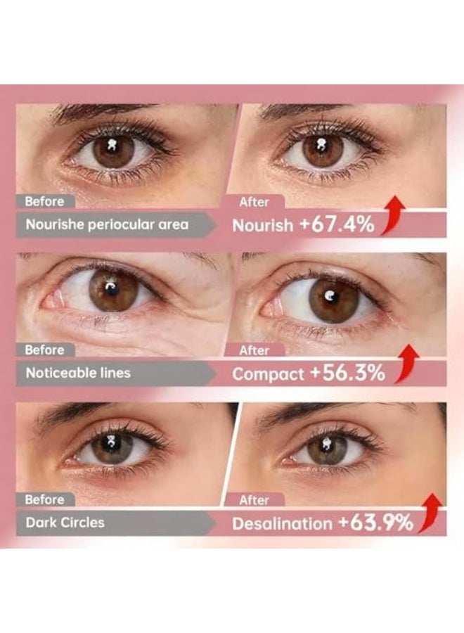 5 Pairs Under Eye Patches, Eye Masks with Bio-Collagen, Peptide Complex, Collagen Eye Patches for Puffy Eyes and Dark Circles, Make The Skin Around The Eyes Soft, Elastic and Delicate - Image 4