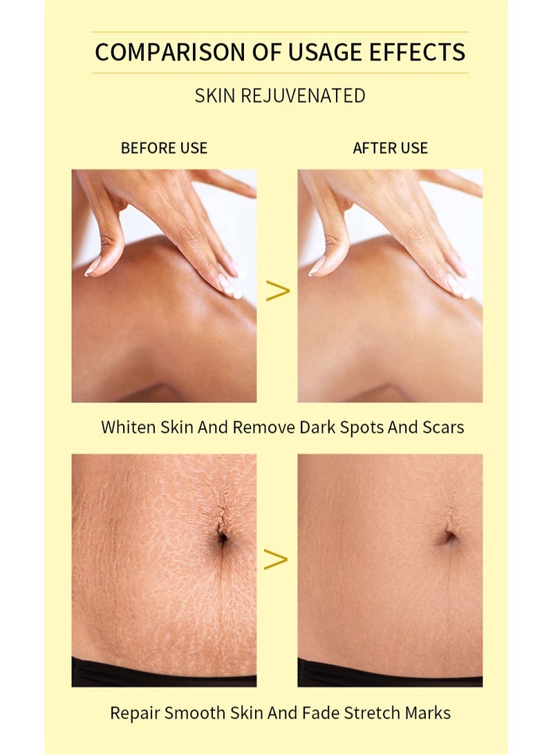 Exfoliating Oil for Dark Skin, Exfoliating Solution With Salicylic Acid, Spot Corrector Body, Brightening Dull Skin And Uneven Tone, Radiant Whitening Moisturizing, Suitable All Types