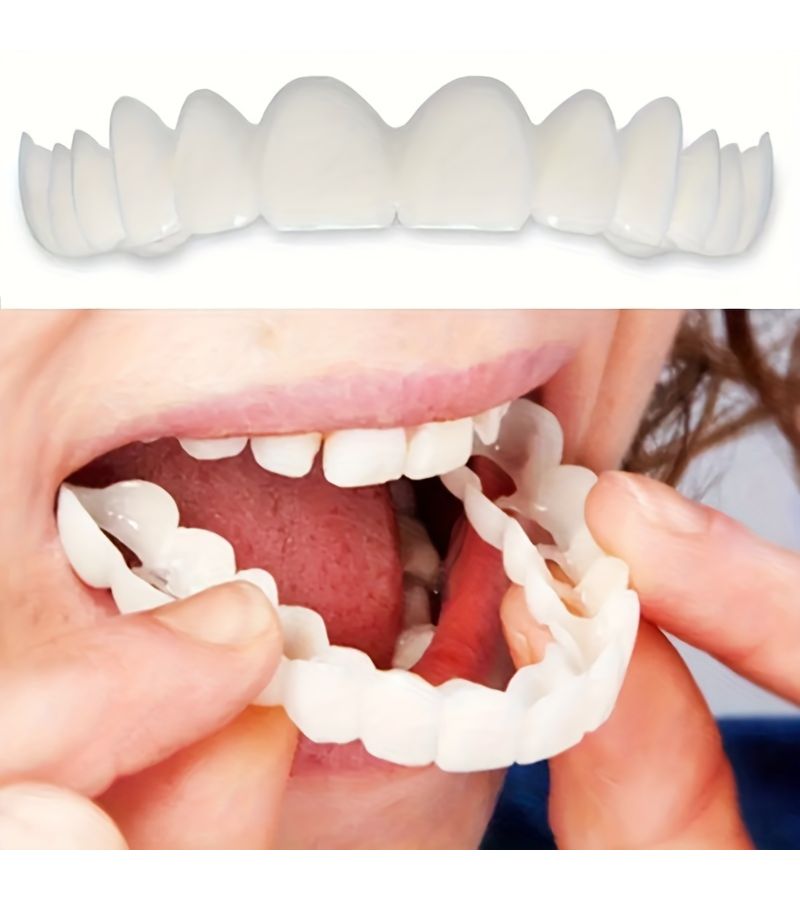 The 8 Piece Set Includes 2 Upper Teeth 2 Lower Teeth And 4 Auxiliary Materials Temporary Cosmetic Dental Veneer Kit Easy Snap On Overlays For A Perfect Smile Upper And Lower Teeth Ideal Gift For Valentine s Day Mother s Day And Father s Day - Image 4