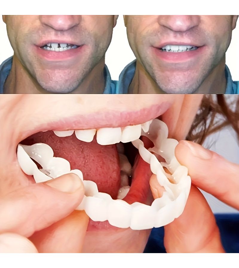 The 8 Piece Set Includes 2 Upper Teeth 2 Lower Teeth And 4 Auxiliary Materials Temporary Cosmetic Dental Veneer Kit Easy Snap On Overlays For A Perfect Smile Upper And Lower Teeth Ideal Gift For Valentine s Day Mother s Day And Father s Day - Image 5
