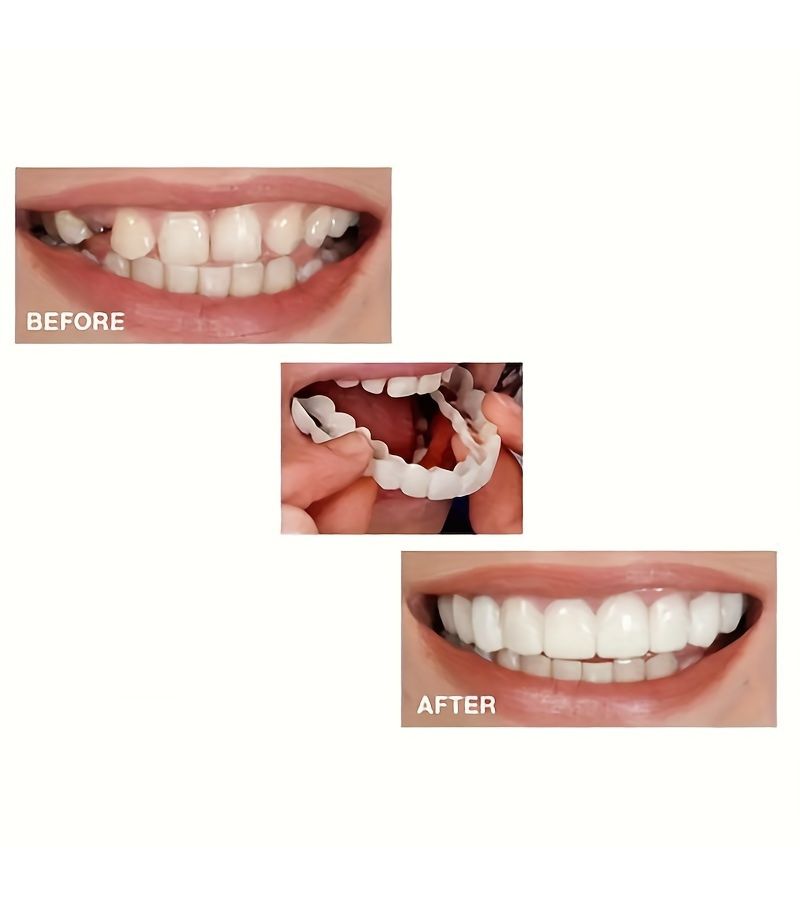 The 8 Piece Set Includes 2 Upper Teeth 2 Lower Teeth And 4 Auxiliary Materials Temporary Cosmetic Dental Veneer Kit Easy Snap On Overlays For A Perfect Smile Upper And Lower Teeth Ideal Gift For Valentine s Day Mother s Day And Father s Day - Image 2