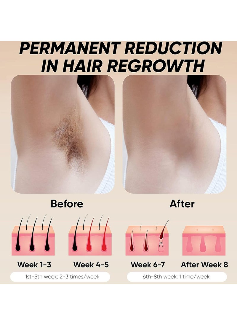 Bosidin Laser Hair Removal Device, Pulse light hair removal device at home 500,000 flashes, Permanent Laser Hair Removal for women and men, Painless hair removal device for armpits, legs, arms  - Image 5
