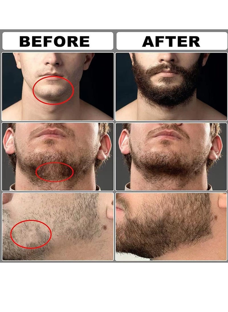 Laseta 9 in 1 Beard Growth Kit - Roller, Serum Oil , Balm and Comb, Stimulate Beard and Hair Growth - Gifts for Men Dad Him Boyfriend Husband Brother  - Image 5