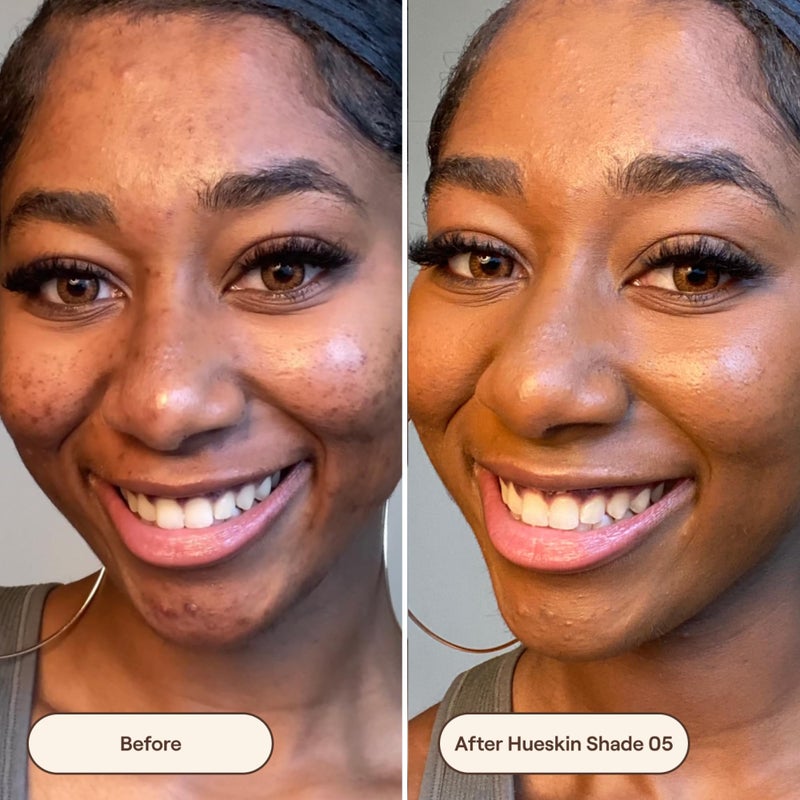 Live Tinted Hueskin Serum Concealer - Medium-to-Full Coverage Concealer with Niacinamide, & Hyaluronic Acid for Dark Circles, Fine Lines & Wrinkles, Buildable Long-Lasting Formula, 0.35 oz - Shade 5 - Image 4