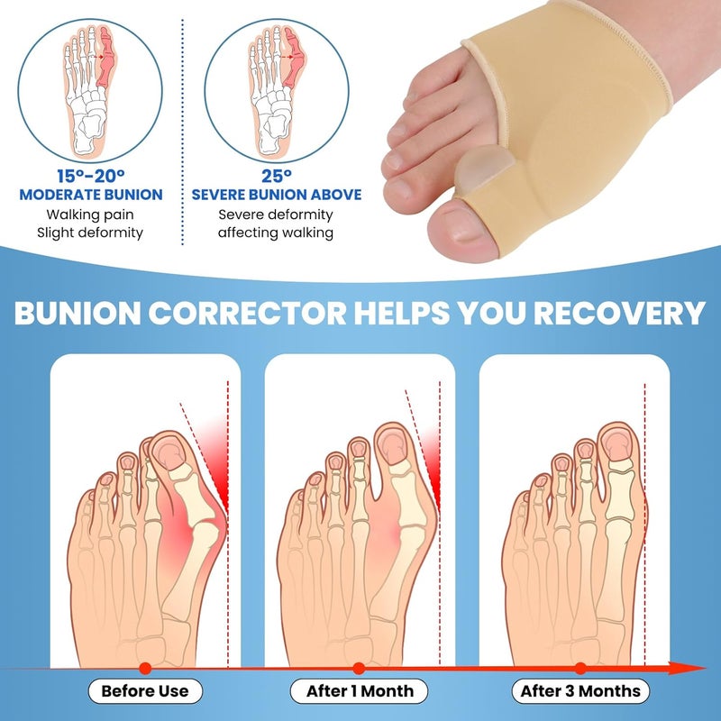 Pnrskter 9PCS Bunion Corrector for Women and Men, Big Toe Straightener, Bunion Protector Bunion Relief Bunion Pad (9PCS) - Image 3