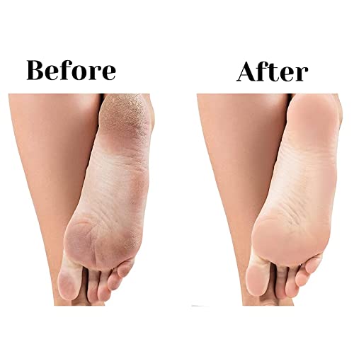 TRITON Professional Double Sided Lazer Plate Foot Scraper, Filer for Hard and Dead Skin Callus Removal, Pedicure Foot Scrubber, Men and Women - Image 5