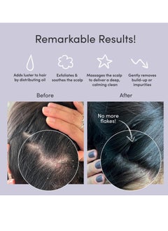 JUPITER Jupiter Exfoliator Brush For Removing Dandruff & Build-Up - Detangling Scrubber For Wet or Dry Hair - Supports Circulation & Growth - For All Hair Types - Black  - Image 2