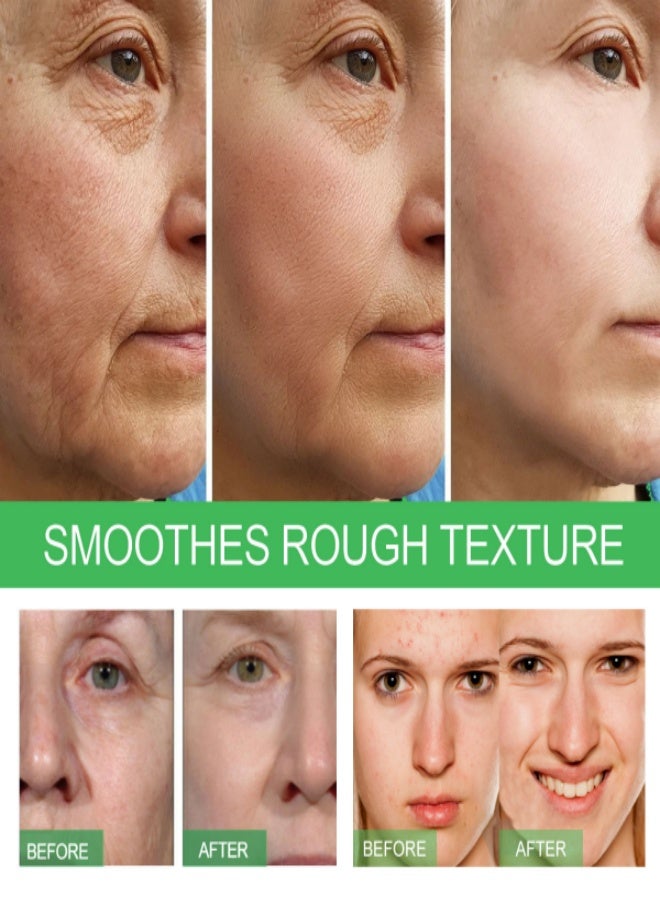 إيلهو EELHOE خلاصة الصبار المرطبة والتفتيح، ترطيب الوجه، تقليل التجاعيد، جوهر الترطيب والتجديد - 30 مل - Image 4