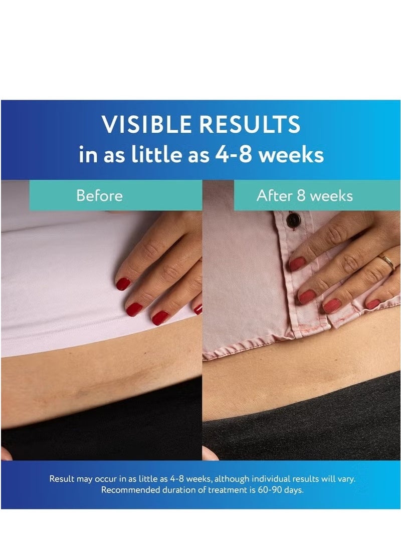 ScarAway Clear Silicone Scar Sheets – White, 10 Count | Flexible, Durable Scar Treatment for Smooth Skin - Image 3