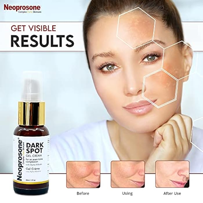 Neoprosone نيوبروسون، مزيل البقع الداكنة للوجه - 1 أونصة سائلة / 30 مل - كريم تفتيح، يقلل من العيوب، بقع الشمس، البقع البنية على: الوجه، الركب، المرفقين، اليدين، المناطق الخاصة - Image 3